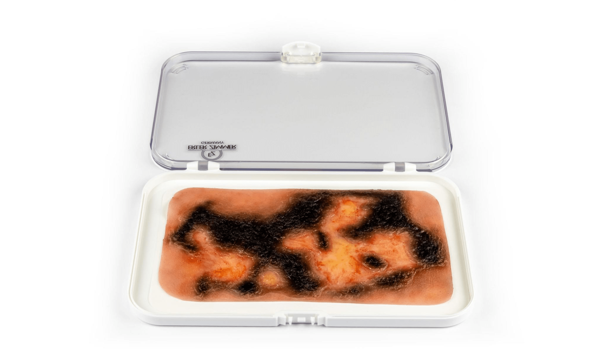 Wundmoulage Brandwunde 3. Grades - Erler - Zimmer